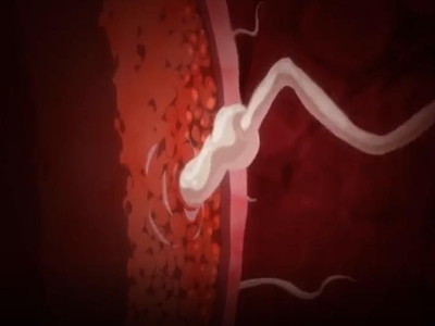 Thumbnail of post image 087