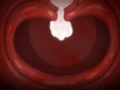 Thumbnail of post image 004